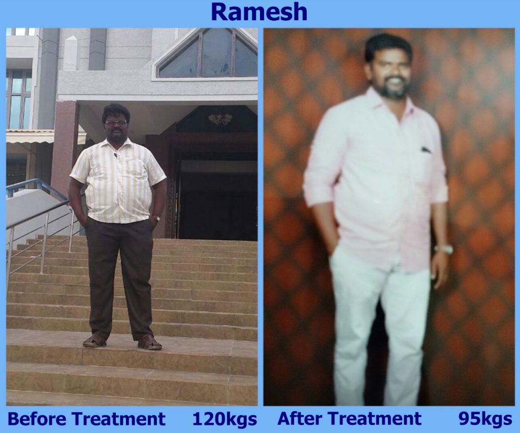 ramesh