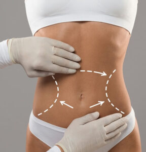 Body Contouring